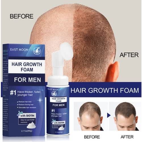 Minoxidil With Biotin Hair Growth Treatment 60ml