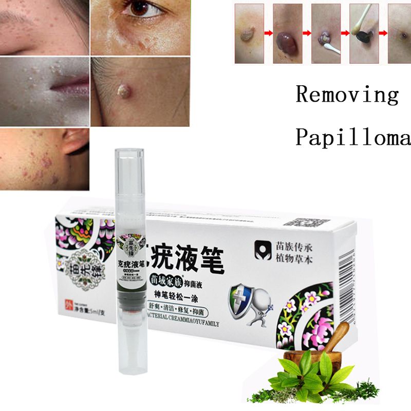 Papillomas Removing Removal Remedy Warts Moles Tags Treatment Skin Verruca 1pc Liquid Anti Of Wart Genital Against Remover From