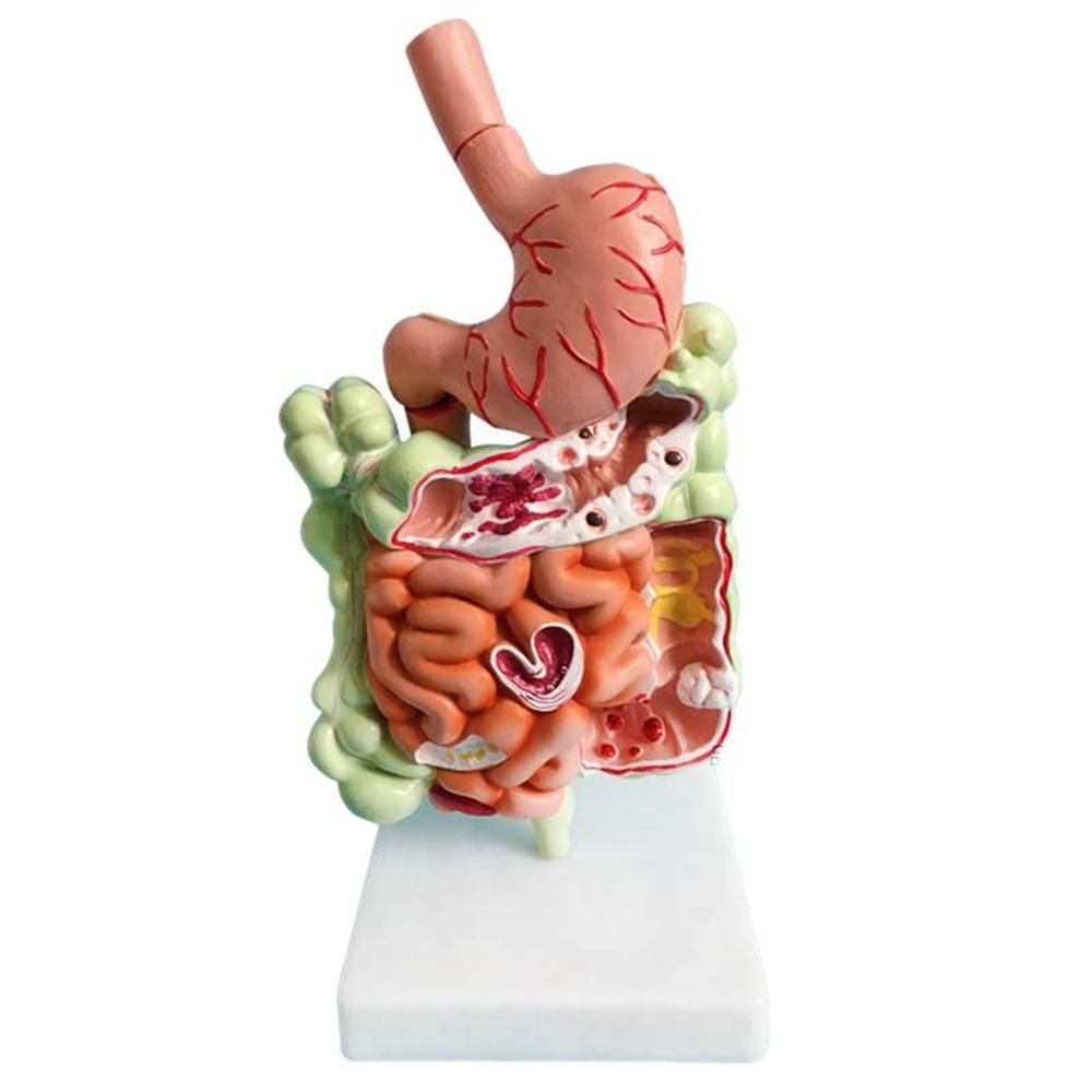 Human Digestive System Model Stomach Anatomy Large Intestine Cecum