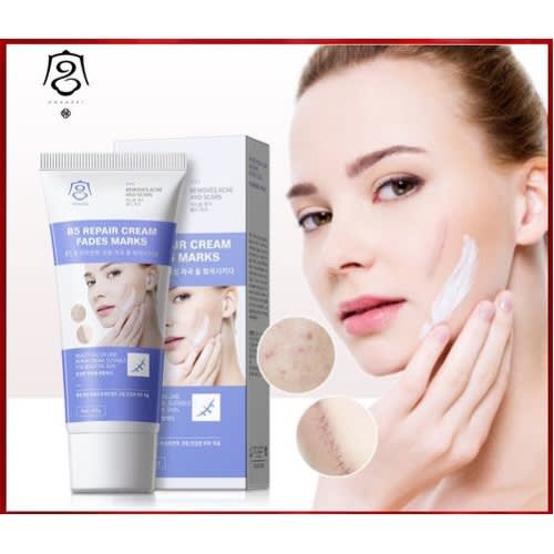 B5 Remove Acne And Scars - Stretch Marks Remover Cream-60g