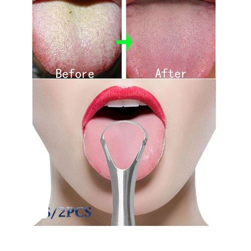 Tongue Cleaner Eliminates Bad Breath X2