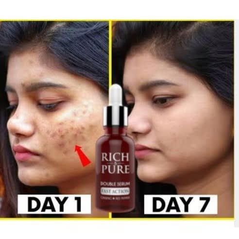 Rich And Pure Spots & Sunburn Removel Serum 30ml
