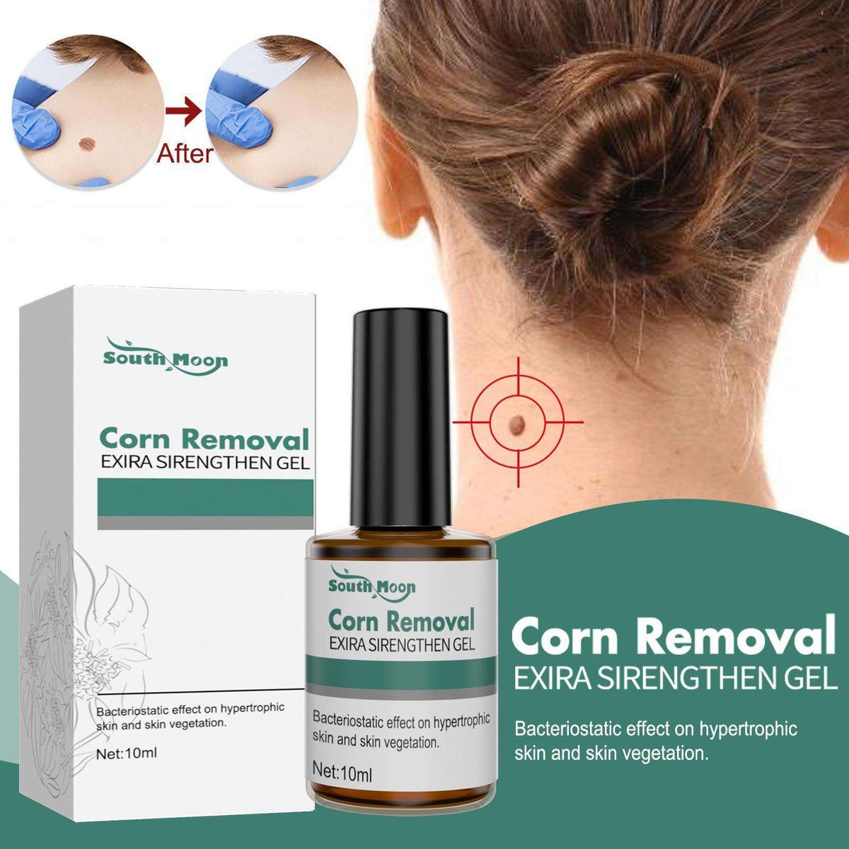 Corn Removal EXIRA SIRENGTH GEL Remove Corn/Warts/Skin Tags