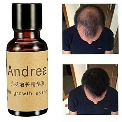 Andrea Fast Hair Growth Essential - For Male And Female