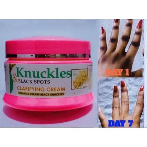 Knucklesdark Spots Repair Hand Cream - 150ml