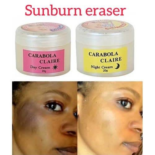 Sunburn Removal Cream - Day & Night - 20g