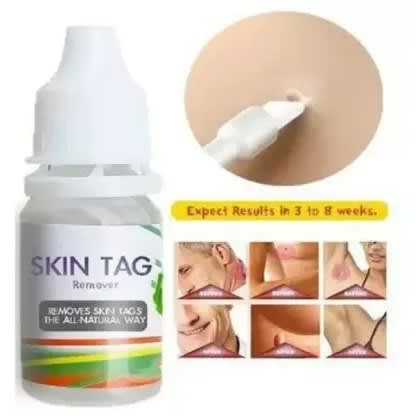 Skin Tag