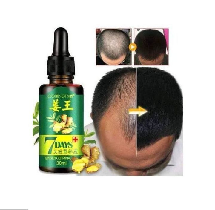 Clothes Of Skin-7Days Ginger