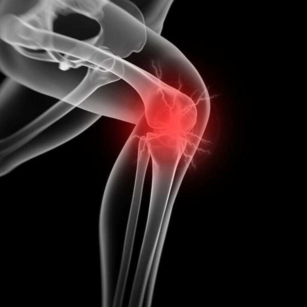 Knee Brace Sleeve Anti-Slip Long Knee Support Black And Blue XL