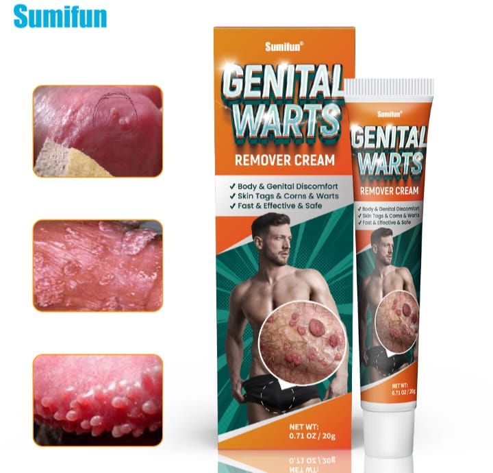 Powerful Genital Wart Removal Cream-20g