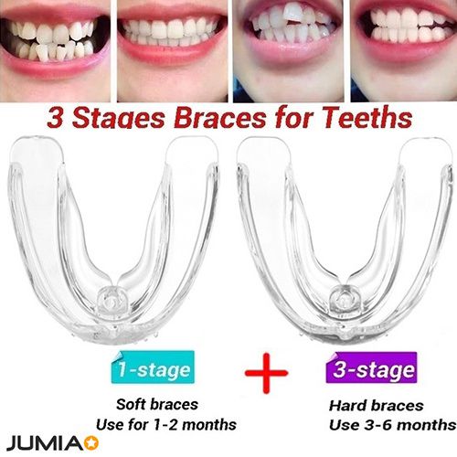 3 Stages Teeth Corrector Bend Brace Aligner-1+3 Stage