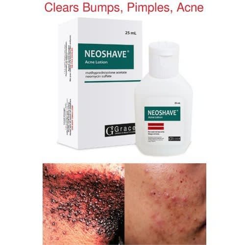 Neo Shave Acne Lotion -Advance Form Of Neomedrol ) For Shave Bumps, Pimples, Acne, Rashes- 25ml