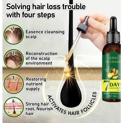 7 Days Ginger Hair Growth Essential Oil - 30ml