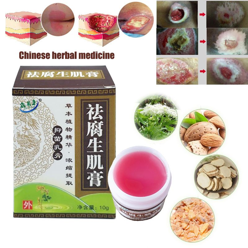 Removal Sores/Decubituses/Pressure Rot Pressure Bedsores Myogenic Cream Festering Ulcer Herbal Healing Wound 1PC Treat Paste