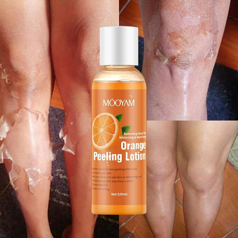 Orange Peeling Lotion - 100ml - One Piece
