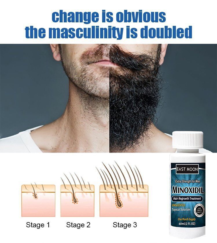 Anti Hair Loss - Hair Loss Treatment - Hair Growth