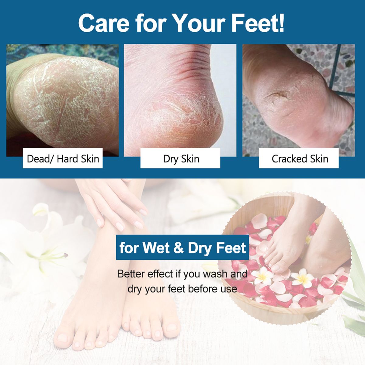 Foot Grinder Callus Remover Feet Pedicure Tools Remove Dead