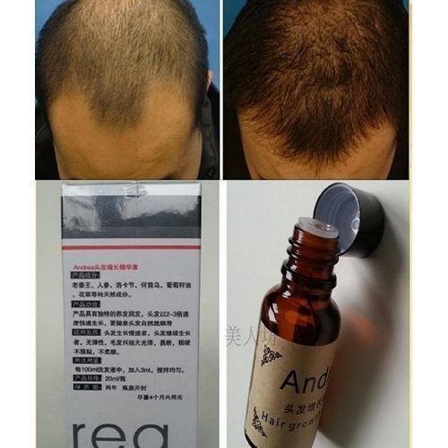 Fastest Hair/Bald Growing Oil Cream- 20ml==