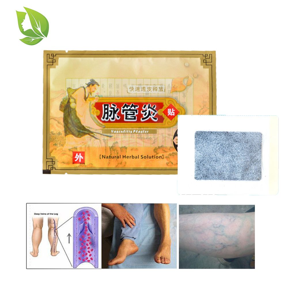 Veins Plaster Relief Pain Pcs Vasculitis Herbal Chinese Cream Varicosity Spider 10 Remedy Patch Angiitis Veins Medicine Varicose