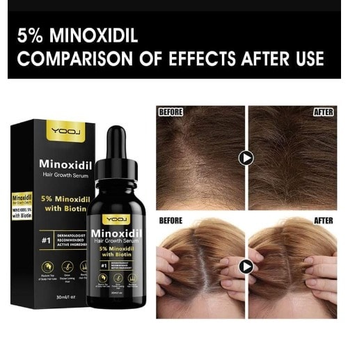 5% Minoxidil Hair Regrowth Serum - 30ml