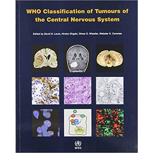 WHO Classification Of Tumours Of The Central Nervous System
