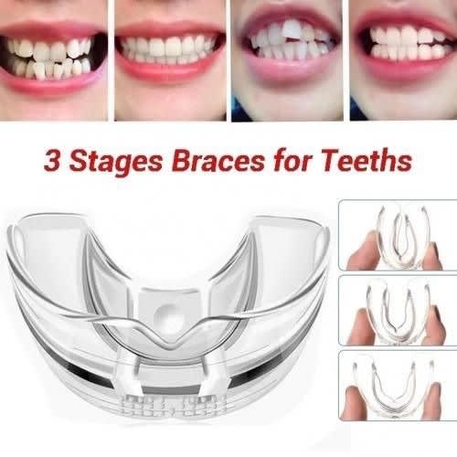 Multi Functional Invisible Braces  Teeth Aligner -3pieces