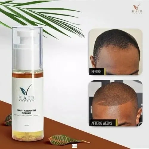 Hair Growth Serum Oil - 50ml