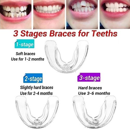 3PCS Stages Teeth Corrector Bend Brace Aligner