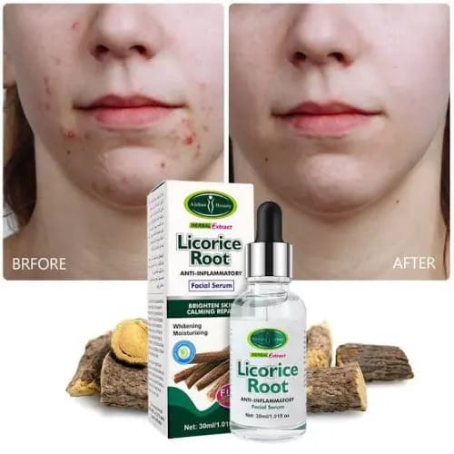 Licorice Root Anti Inflammatory Facial Whitening Serum - 30ml