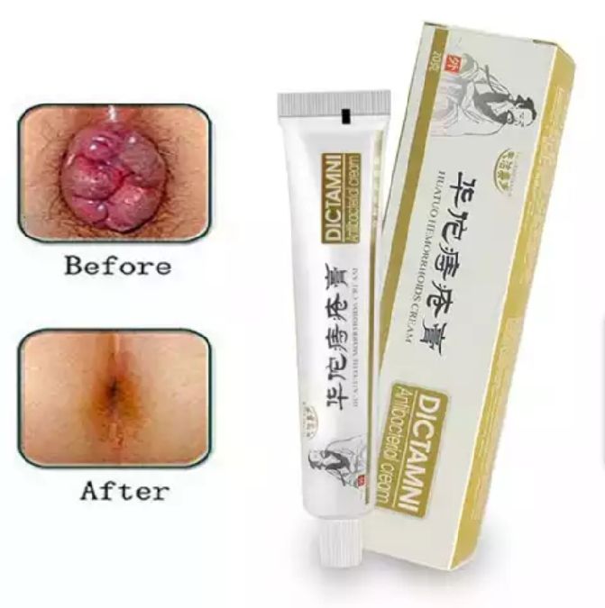Powerful Chinese  Haemorrhoid  Treatments Cream