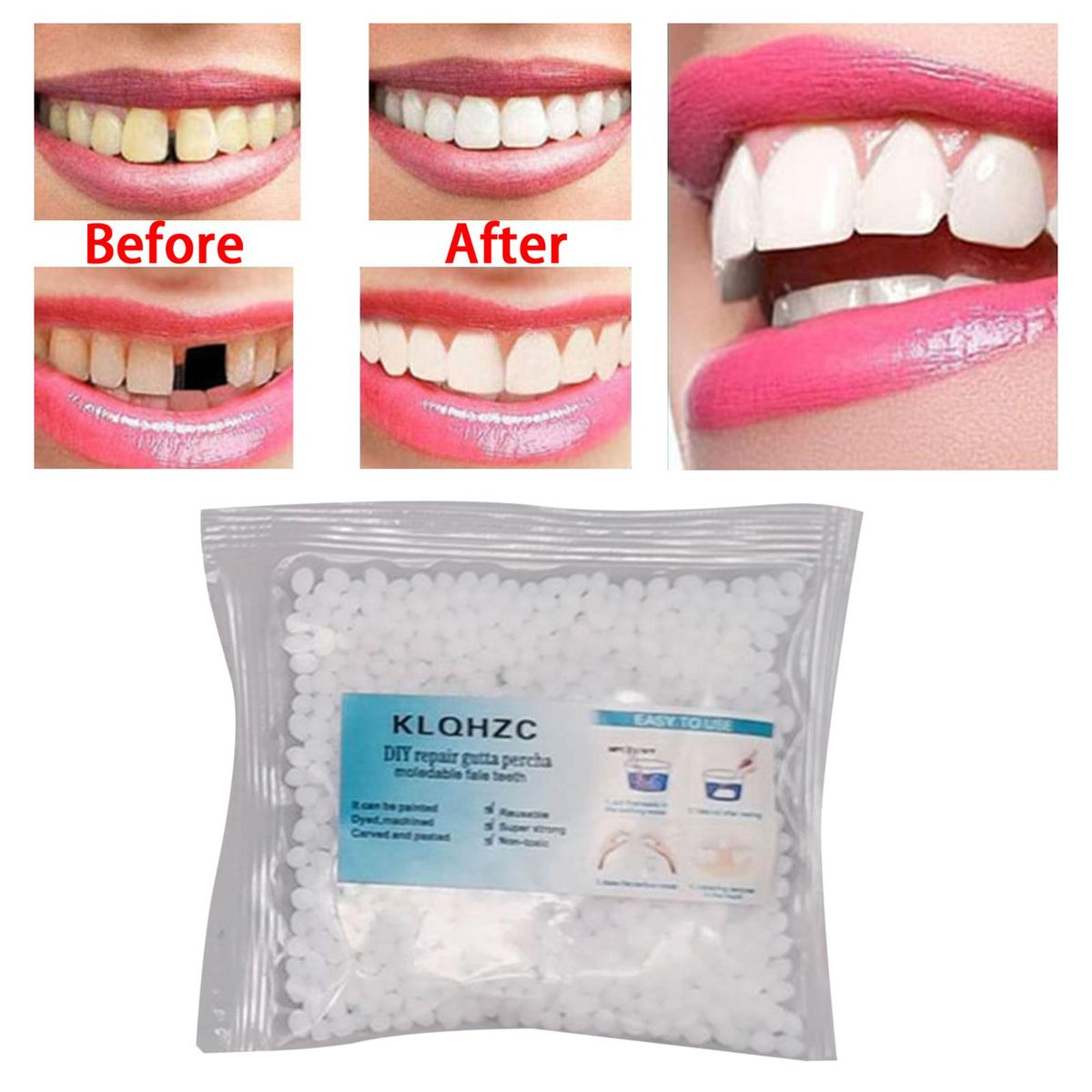 Temporary Tooth Repair  25G Repair Granules 8x8cm