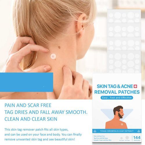 144pcs Skin Tags Moles Remover Patches Gift Wart Treatment Liquid Pen Remover Freckle Wart Tag Fast Healing Non-Drying Skin Care