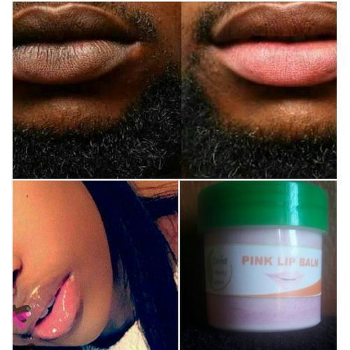 Unisex Permanent Pink Lips Balm/Cream( Visible Result In 3 DAYS )