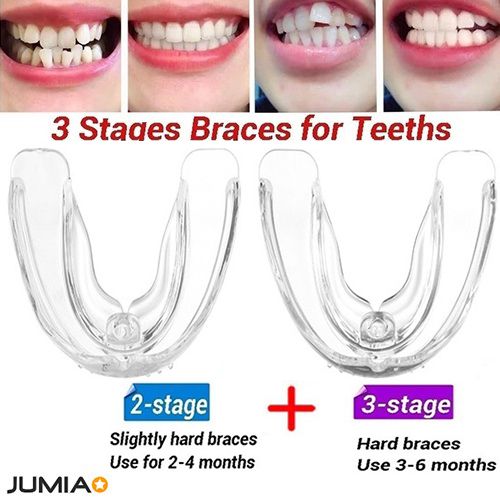3 Stages Teeth Corrector Bend Brace Aligner-2+3 Stage