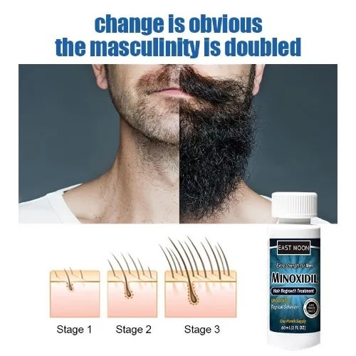 Hair And Beard Growth Oil - Minoxidil - Fast Beard Growth - 60ml