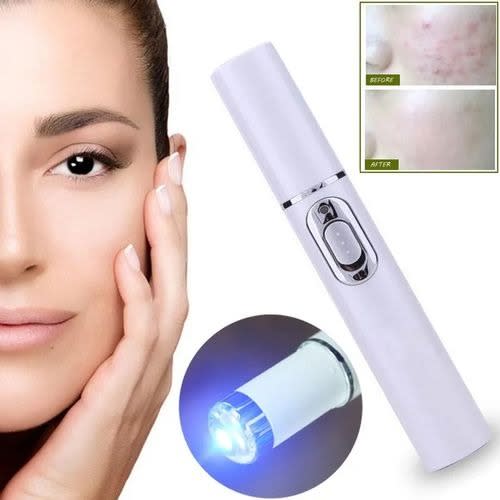 Acne Laser Pen for Varicose Veins Wrinkle Removal & Soft Scar Remover