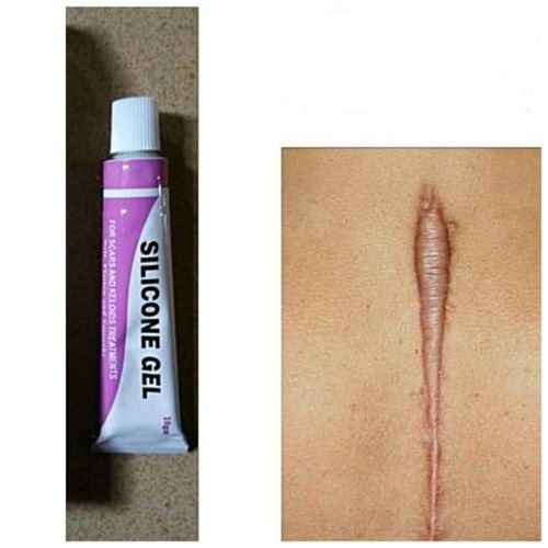 Scar/Tribal Mark/Keloid Silicone Gel Flattener
