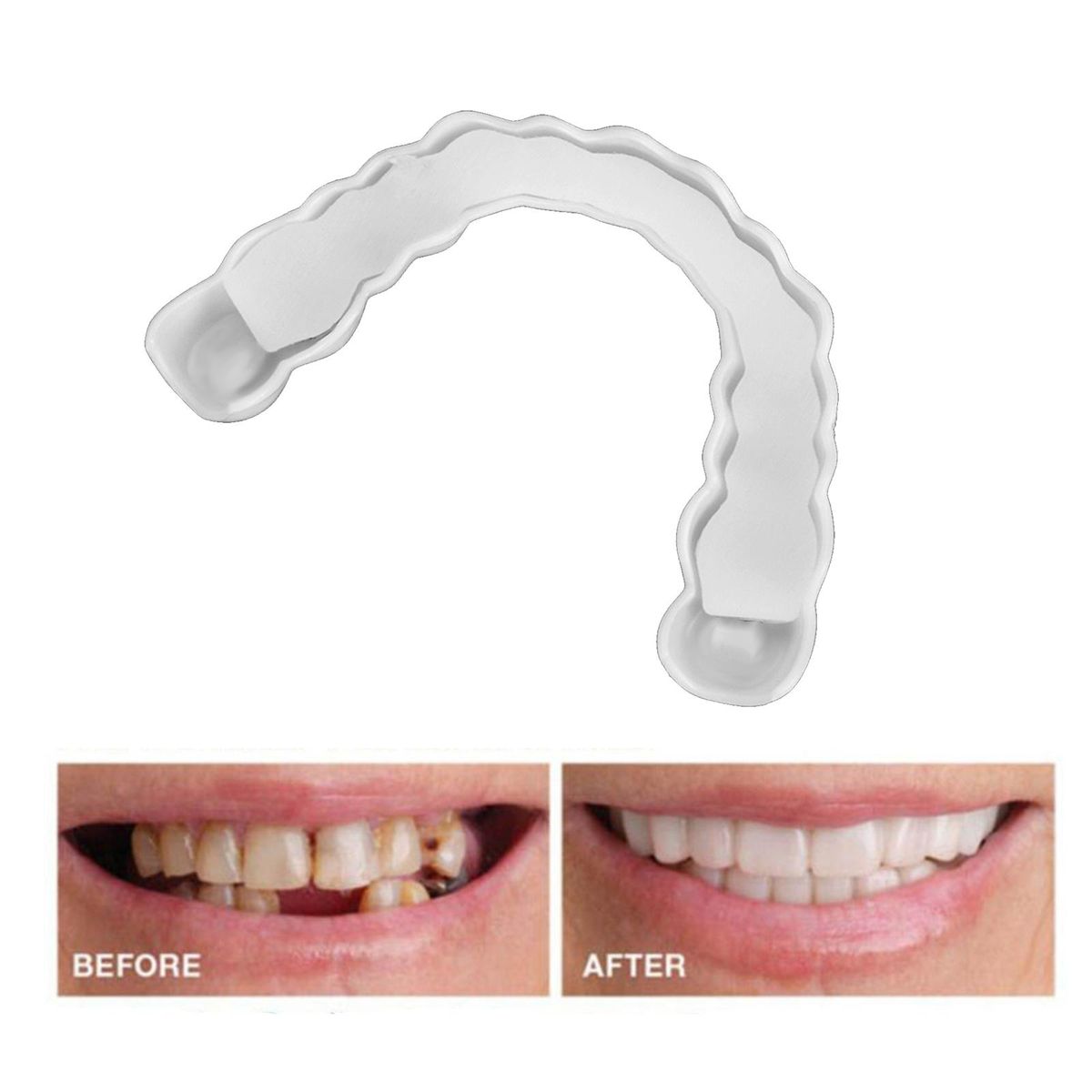 Silicone Smiling Snap Lower Upper False   Veneers