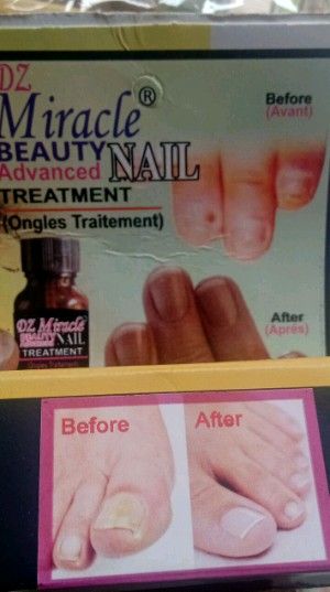 Miracle Beauty Advance Nail Treatment