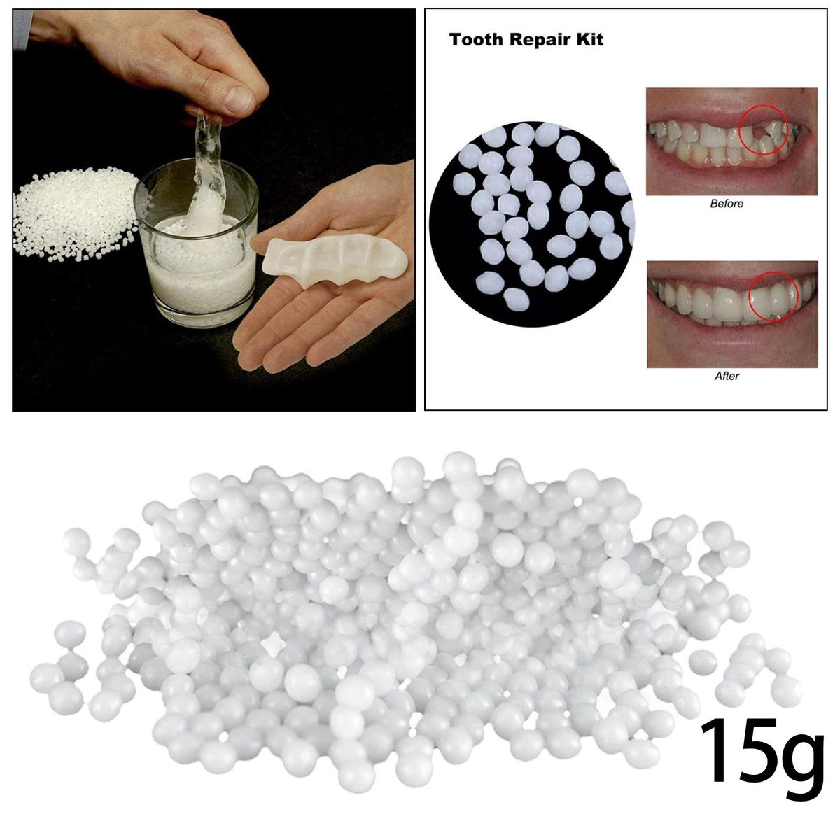 Temporary Teeth Repair Kit Filling The Missing Broken Tooth And Gaps