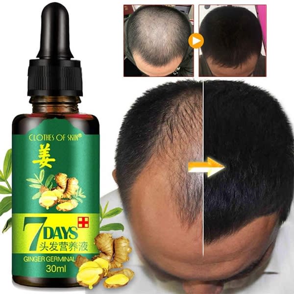 7 Days Ginger Hair Growth Oil -30ml -1 Piece