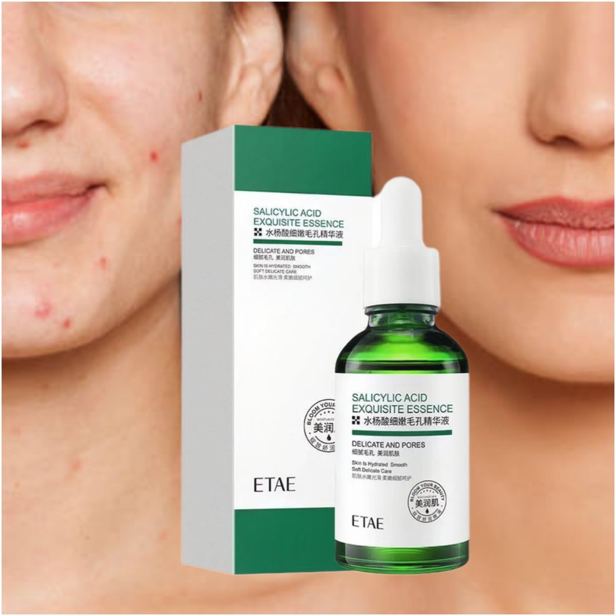 Salicylic Acid Acne Remedy  & Soothing Face Serum +Hyaluronic