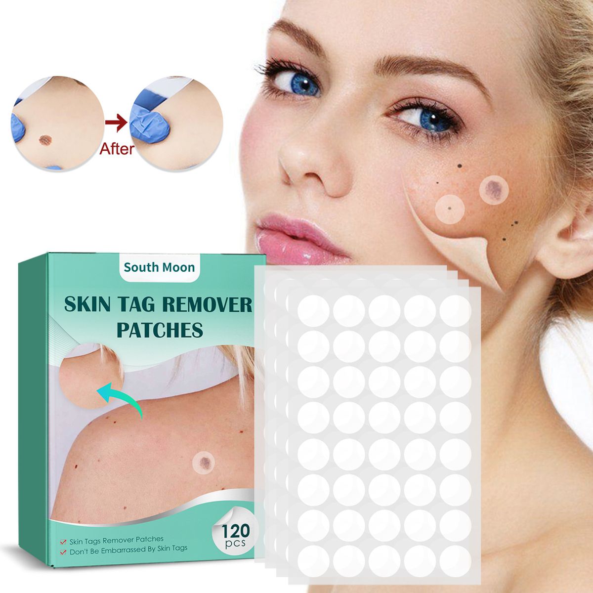 120Pcs Skin Tag Remover Patch Wart Cone Removal Painless