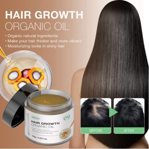 Hair Growth Oil-hair Growth Oil Fast Powerful/hair Grow-120g