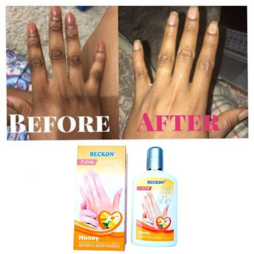 Dark Knuckles Repair Hand Moisturizing Cream - 100ml